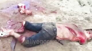 Man's Arms And Legs Chopped Off While Still Alive 