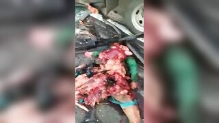 A Man's Body Was Turned Into A Piece Of Meat Due To An Accident