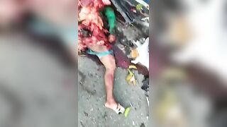 A Man's Body Was Turned Into A Piece Of Meat Due To An Accident