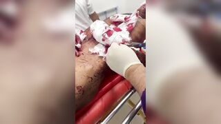 [Part 1] Horrific Machete Attack Victim Hospitalized