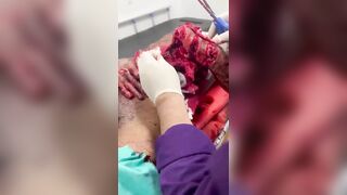 [Part 1] Horrific Machete Attack Victim Hospitalized