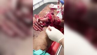 [Part 1] Horrific Machete Attack Victim Hospitalized