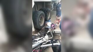 Motorcyclist's Legs Crushed By Truck Wheels 