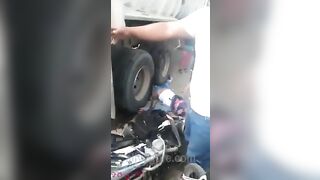 Motorcyclist's Legs Crushed By Truck Wheels 