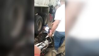 Motorcyclist's Legs Crushed By Truck Wheels 