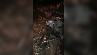 Motorcyclist With Broken Leg After Accident 