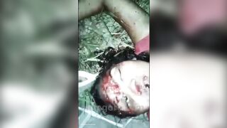 Mutilation Of The Victim's Head 