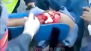 Paramedics Try To Save Injured Leg 