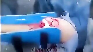 Paramedics Try To Save Injured Leg 