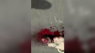 Guy Strangled, Eyes Gouged Out. Brazil 