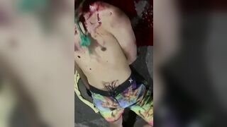 Guy Strangled, Eyes Gouged Out. Brazil 