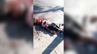 The Man Was Shot Multiple Times In The Head And Died 