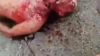 The Man's Throat Had Been Cut And They Were Trying To Behead Him