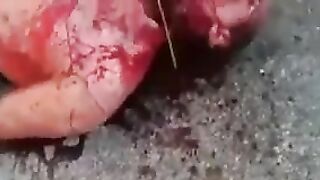 The Man's Throat Had Been Cut And They Were Trying To Behead Him