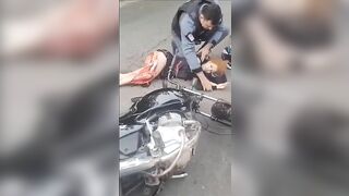 A Woman Had Flesh Torn Off Her Legs After An Accident 