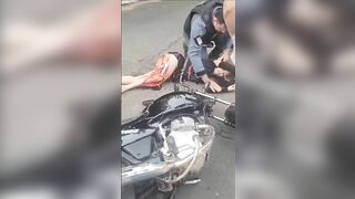 A Woman Had Flesh Torn Off Her Legs After An Accident 