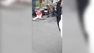 A Woman Had Flesh Torn Off Her Legs After An Accident 