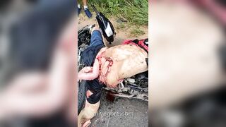 Badly Mutilated Body Of Motorcyclist 