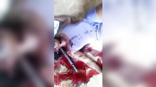 Aunt Toothless Gets Her Neck Stabbed With A Machete 
