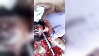 Aunt Toothless Gets Her Neck Stabbed With A Machete 