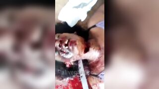 Aunt Toothless Gets Her Neck Stabbed With A Machete 