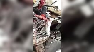 Truck Driver With Disfigured Face. Aftermath 