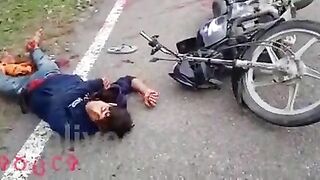 Two Motorcyclists Lose Legs After Accident 