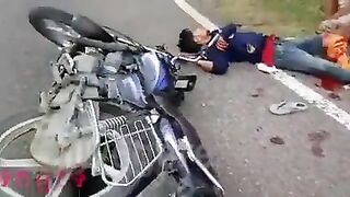 Two Motorcyclists Lose Legs After Accident 