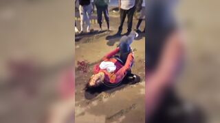 Two Motorcycles Collided, Woman's Legs Were Severely Shattered