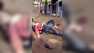 Two Motorcycles Collided, Woman's Legs Were Severely Shattered