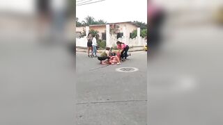 Young Woman Breaks Her Leg While Riding A Motorcycle