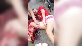 Young Woman Breaks Her Leg While Riding A Motorcycle
