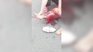 Young Woman Breaks Her Leg While Riding A Motorcycle