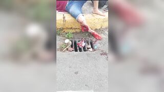 Young Woman Breaks Her Leg While Riding A Motorcycle