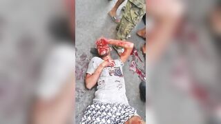 Two Young People Involved In Serious Traffic Accident