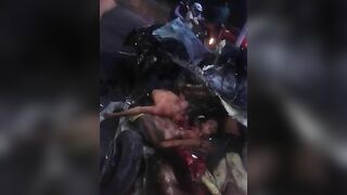 Accident Between Car And Bus