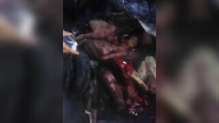 Accident Between Car And Bus