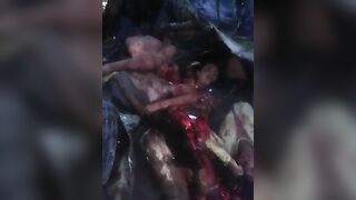 Accident Between Car And Bus