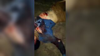 The Aftermath Of A Brutal Bicycle Accident