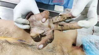 Autopsy Notes Of A Man Who Was Electrocuted