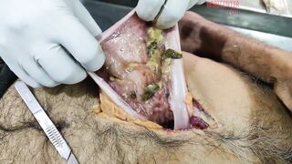 Autopsy Notes Of A Man Who Was Electrocuted