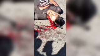 Bicyclist Hits Truck And Is Pierced By Mirror