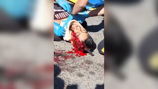 Bicyclist Hits Truck And Is Pierced By Mirror
