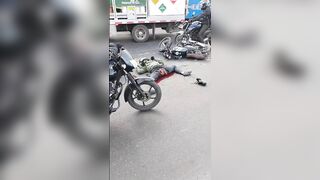 Biker Shows Woman His Ripped Genitals