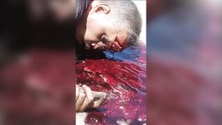 The Cyclist Was Still Breathing, With Blood And Brain Pouring Out Of His Skull