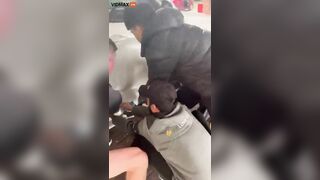 Man's Calf Broken By Car Door While Driving