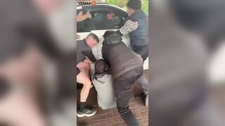 Man's Calf Broken By Car Door While Driving