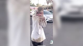 This Guy Is Running Around Bleeding