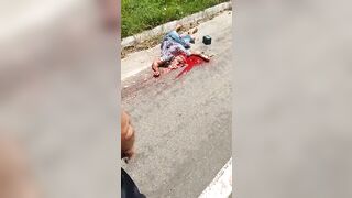 This Guy's Head Was Crushed.