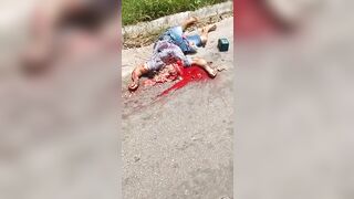 This Guy's Head Was Crushed.